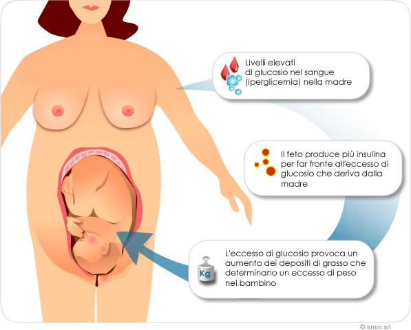 diabeteGest