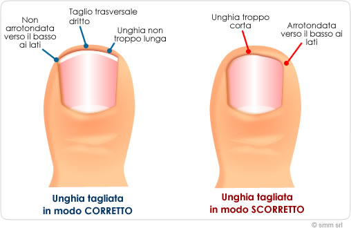 unghiePiedi