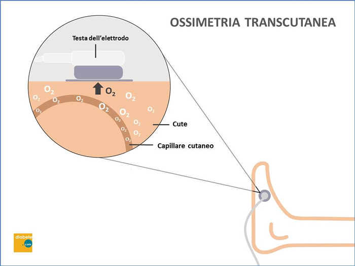 ossimetria transcutanea diabete.com