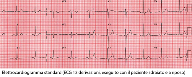elettrocardiogramma