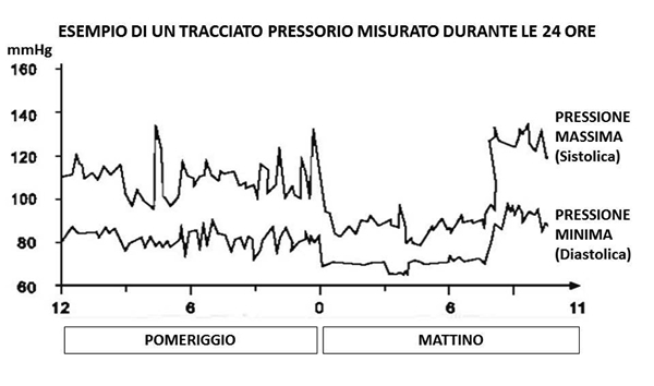 esempio di un tracciato pressorio misurato durante le 24 ore