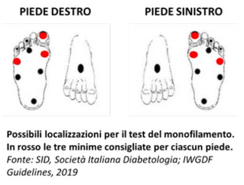 Localizzazioni per il test del monofilamento Semmes Weinstein - Diabete.com