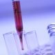 Valori di riferimento della glicemia o glucosio nel sangue- Diabete.com