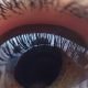 Screening della retinopatia diabetica: prima esperienza italiana di telemedicina