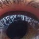 Screening della retinopatia diabetica: prima esperienza italiana di telemedicina