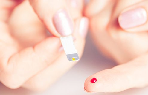 Dispositivi per monitoraggio diabete: bandi di gara garantiscano libertà di scelta in un’ottica di appropriatezza
