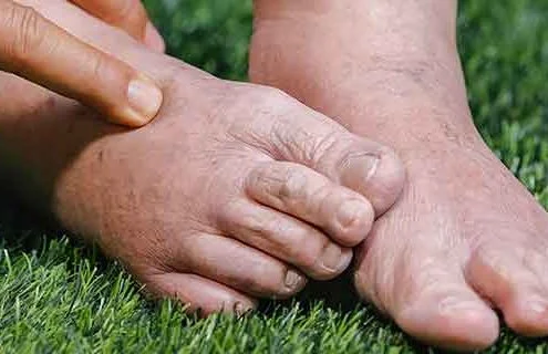 Il piede di Charcot: che cosa è importante sapere