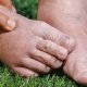 Il piede di Charcot: che cosa è importante sapere