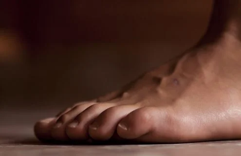 Piede diabetico: complicanza ineluttabile? - Diabete.com