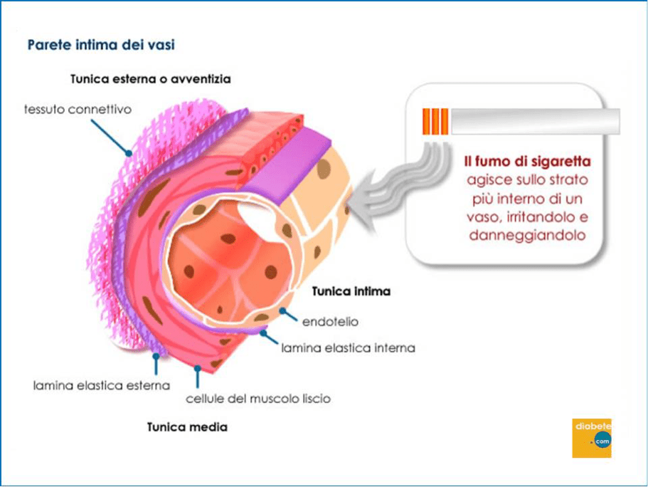 arteopatia periferica degli arti inferiori - PAD
