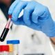La curva da carico di glucosio: da un vecchio test, nuove indicazioni più precise per la diagnosi di diabete
