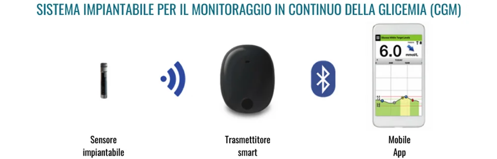 Il sistema impiantabile per il monitoraggio in continuo della glicemia (CGM)