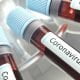 AIFA: istituita la nuova “Unità di crisi Coronavirus”