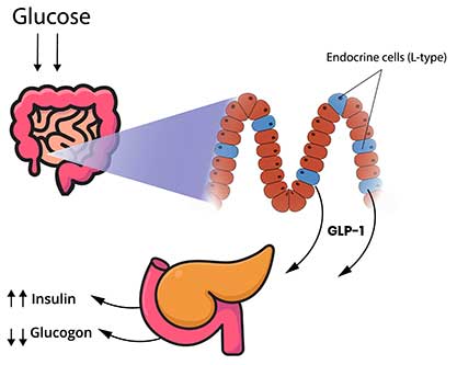 Il GLP-1 - Glucagon-like Peptide-1