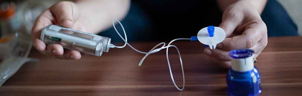 Insulina e diabete: un approccio sempre più ad alta tecnologia