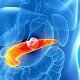 Diabete.com - Pancreas Artificiale Bionico Impiantabile