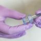 Diabete.com - Malattie Autoimmuni e Filler di Acido Ialuronico