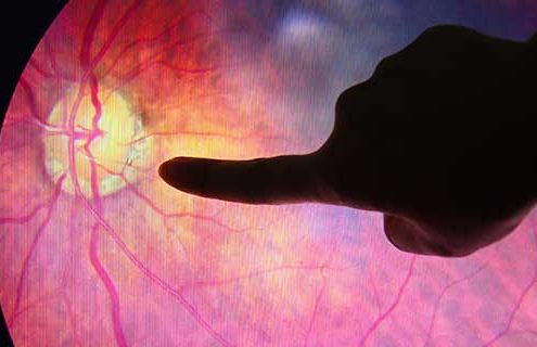 Prevenzione e la cura della Retinopatia Diabetica: Meteda investe nell’intelligenza artificiale applicata all’oftalmologia