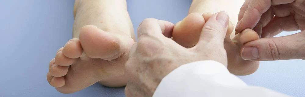 Piede diabetico: cause, sintomi, novità terapeutiche