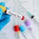 Tiroide: genetica, familiarità e cronicità