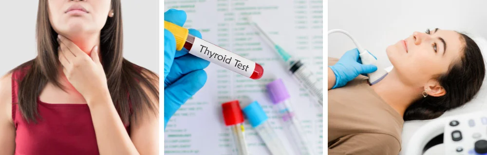 Tiroide: genetica, familiarità e cronicità