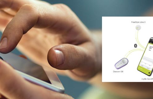 Ypsomed ha lanciato il primo sistema per l’erogazione automatizzata di insulina con FreeStyle Libre 3