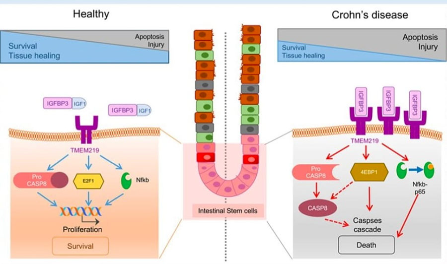 Nuove strategie terapeutiche per colite ulcerosa e malattia di Crohn
