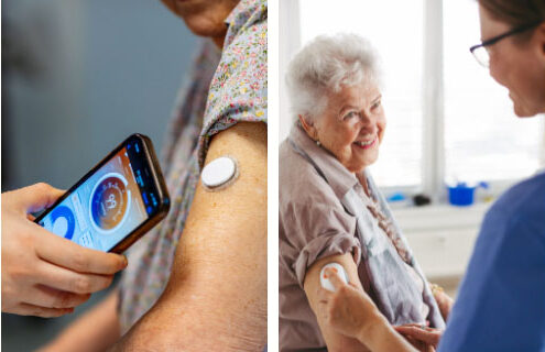 Diabete: come applicare correttamente il sensore per la glicemia