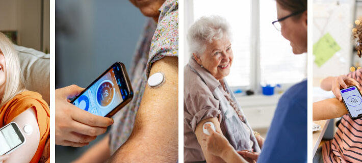 Diabete: come applicare correttamente il sensore per la glicemia