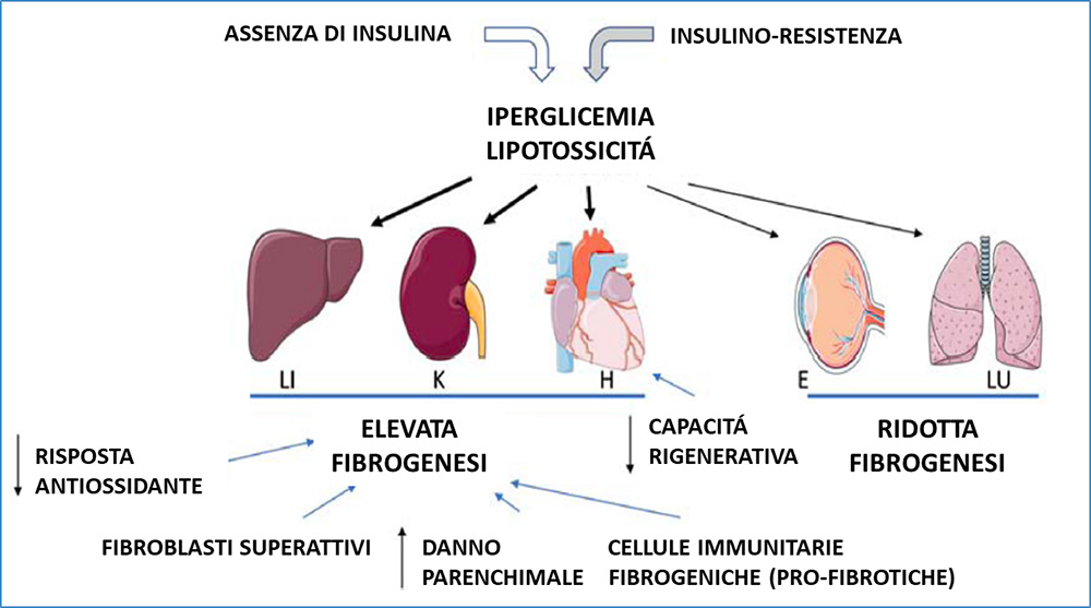 Fibrosi Diabetica