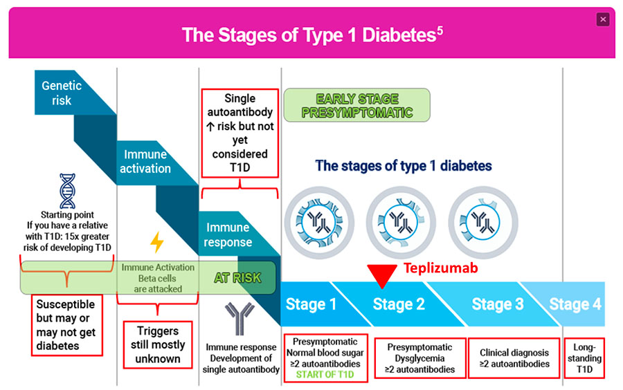 teplizumab - Fasi Diabete Tipo 1