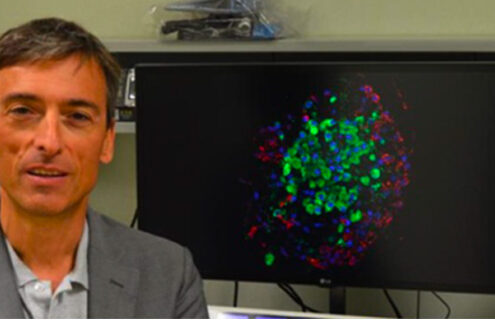 Diabete di tipo 1: oggi è possibile ritardare l’esordio della malattia