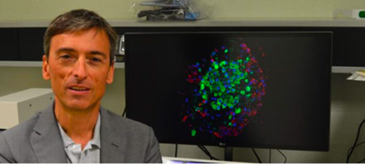Diabete di tipo 1: oggi è possibile ritardare l’esordio della malattia