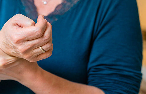 Obesità e artrite reumatoide: quando il peso “alimenta” l’infiammazione