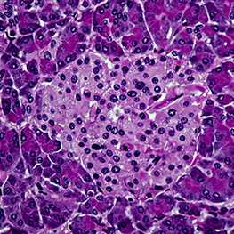 Isole pancreatiche