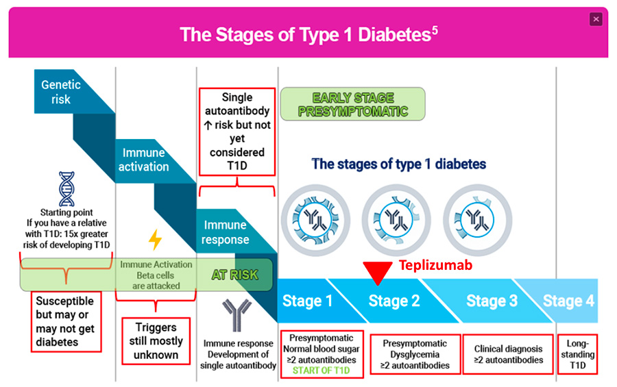 I quattro stati della storia naturale del Diabete Tipo 1