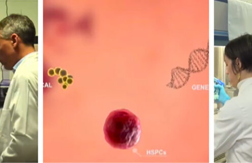 Immunostem, in studio la nuova frontiera contro il diabete tipo 1